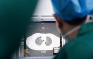 COVID-19: pacienții recuperați au funcția pulmonară parțial redusă