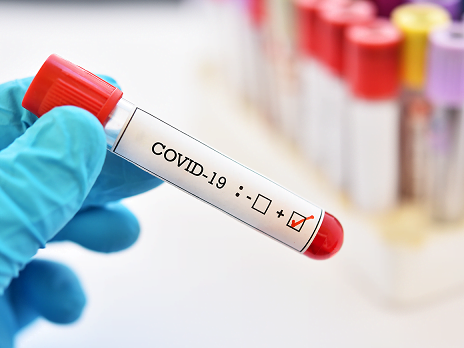 Vezi câte cazuri noi de coronavirus au fost azi!